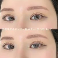 画像1682：施術症例